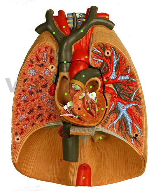 Lung Model-Open Heart